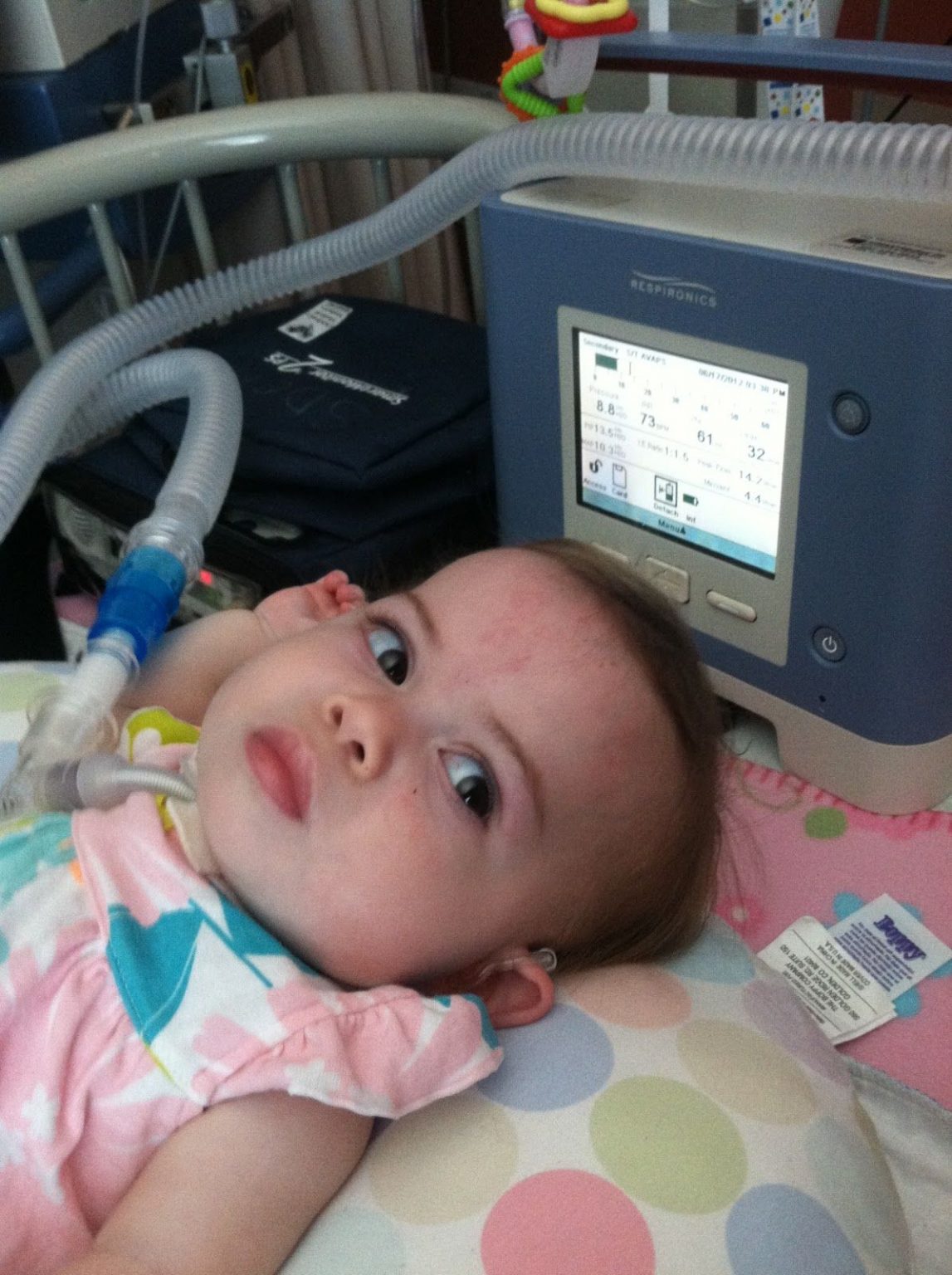 Philips Respironics Trilogy 200 Portable Ventilator Compass Medical