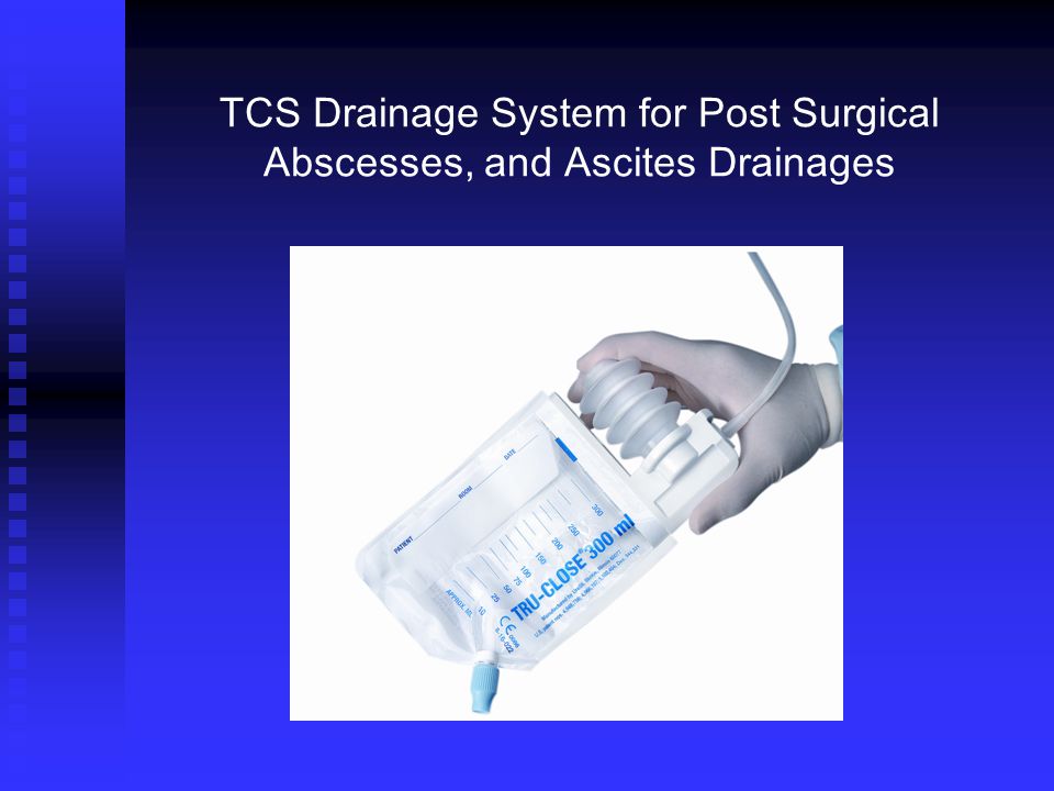 Uresil TRUCLOSE Suction Drainage System Compass Medical